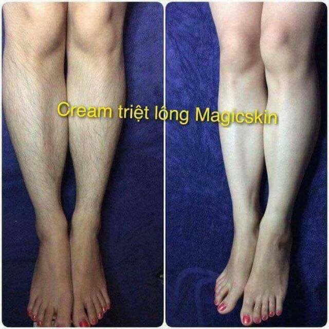 KEM TẨY LÔNG MAGIC SKIN | BigBuy360 - bigbuy360.vn