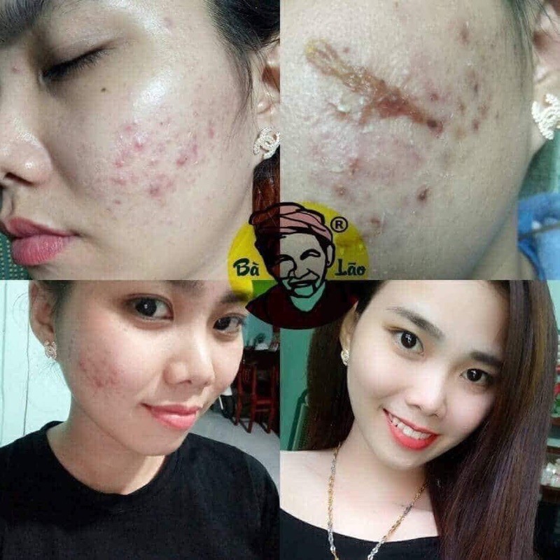 Serum tái tạo cao cấp Bà Lão