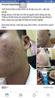 Kem PG collagen sụn cá hồi