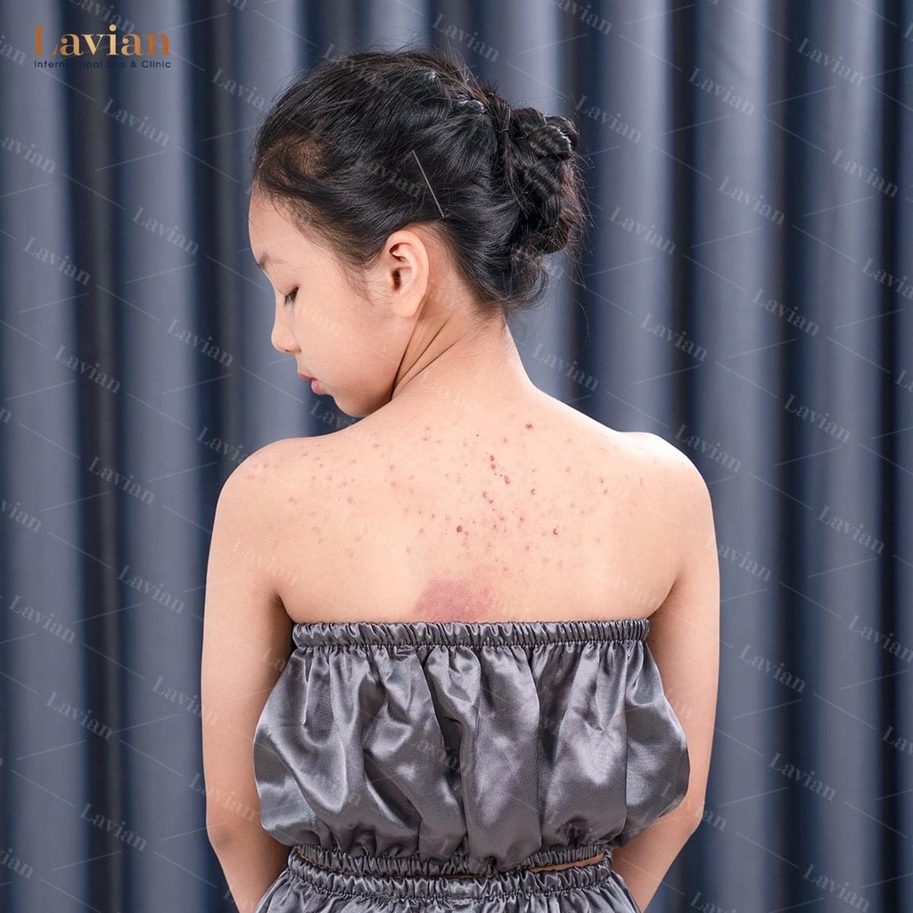 Bigsize Bộ quây giảm béo, bộ đồ tắm trắng spa vải lụa cao cấp, dày dặn - hàng loại 1