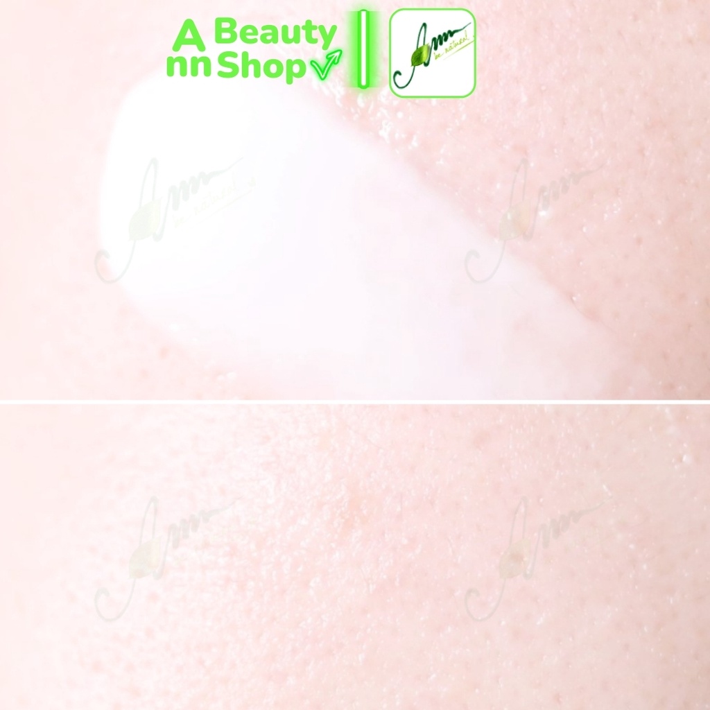 Kem Dưỡng Ẩm Coreana AMPLE:N Hyaluron Shot Cream