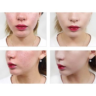 Phấn nước april skin Hàn Quốc