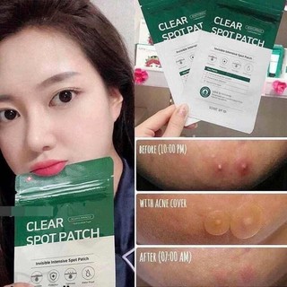 Miếng dán hút nhân mụn some by mi clear spot patch some by me