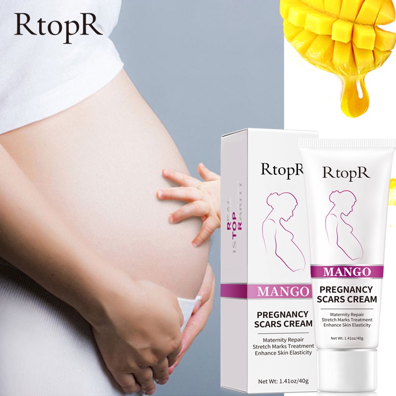 Kem Rtopr Cho Phụ Nữ Mang Thai Hỗ Trợ Giảm Sẹo Rạn Da Chống Lão Hóa Và Nếp Nhăn 40g