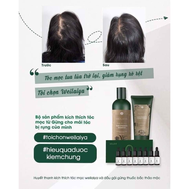 Mini Set Gội Xả Gừng Hà Thủ Ô Kích Mọc Tóc Bóng Mượt WEILAIYA Ginger 20ML + 20ML