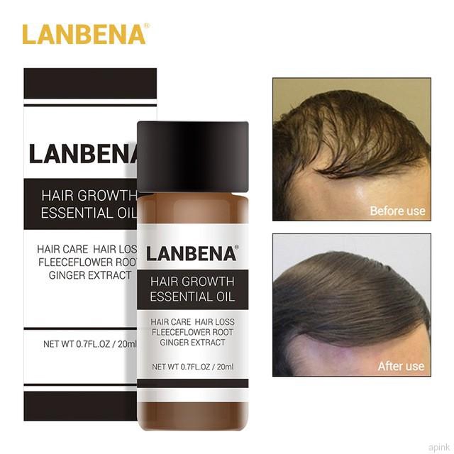 Tinh dầu kích thích mọc tóc LANBENA 20ml chất lượng cao
