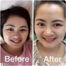 Mặt nạ nhau thai cừu Hàn Quốc Daily Beauty trắng da, mờ nám, sạch mụn - Hộp 6 miếng