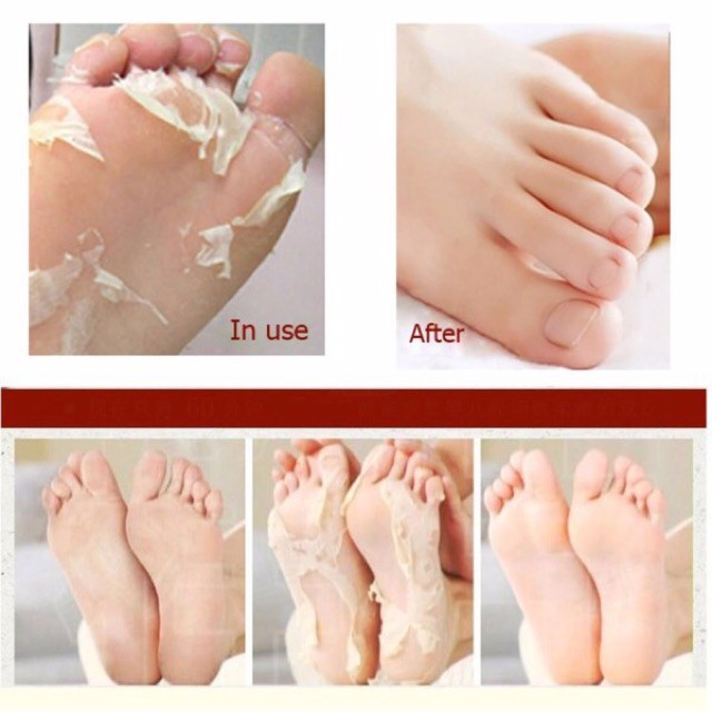 [Chuẩn Nhật] Túi ủ tẩy tế bào chết da chân, bong da chân Nhật Bản - Lavender Foot, Mino Foot - Giảm nứt gót, mịn da chân