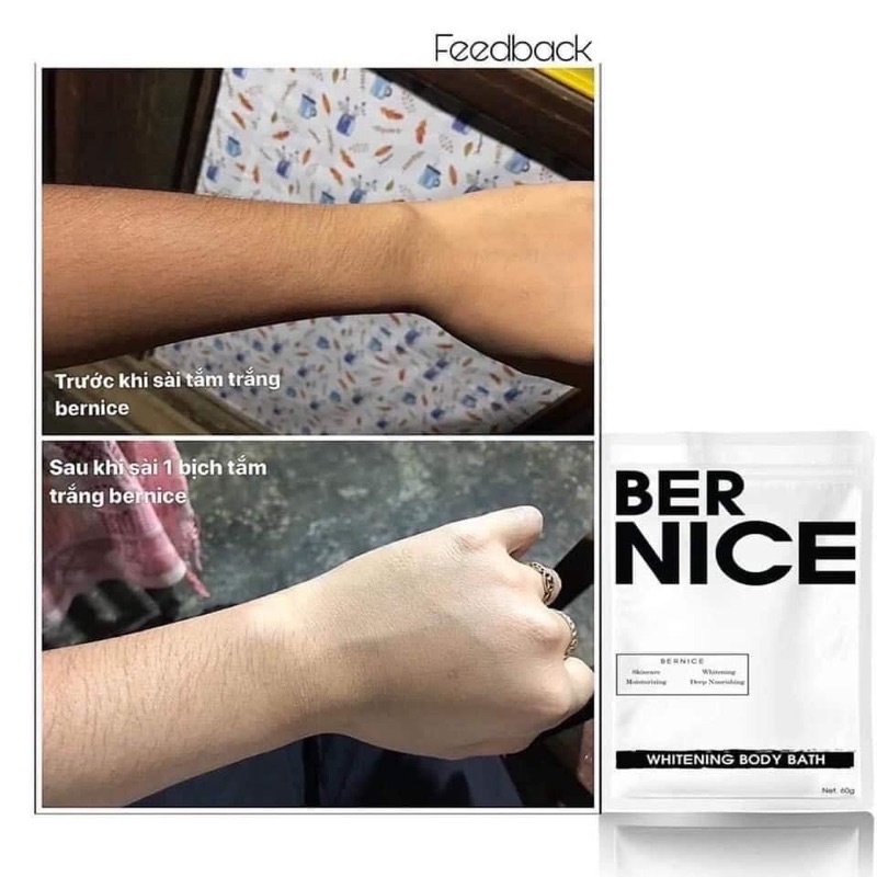 COMBO 3 GÓI TẮM TRẮNG BERNICE | BigBuy360 - bigbuy360.vn