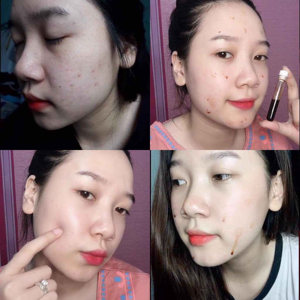 Combo 10 - 50 Ống Cao Lá Nam 5ml Nhà Làm Handmade | BigBuy360 - bigbuy360.vn