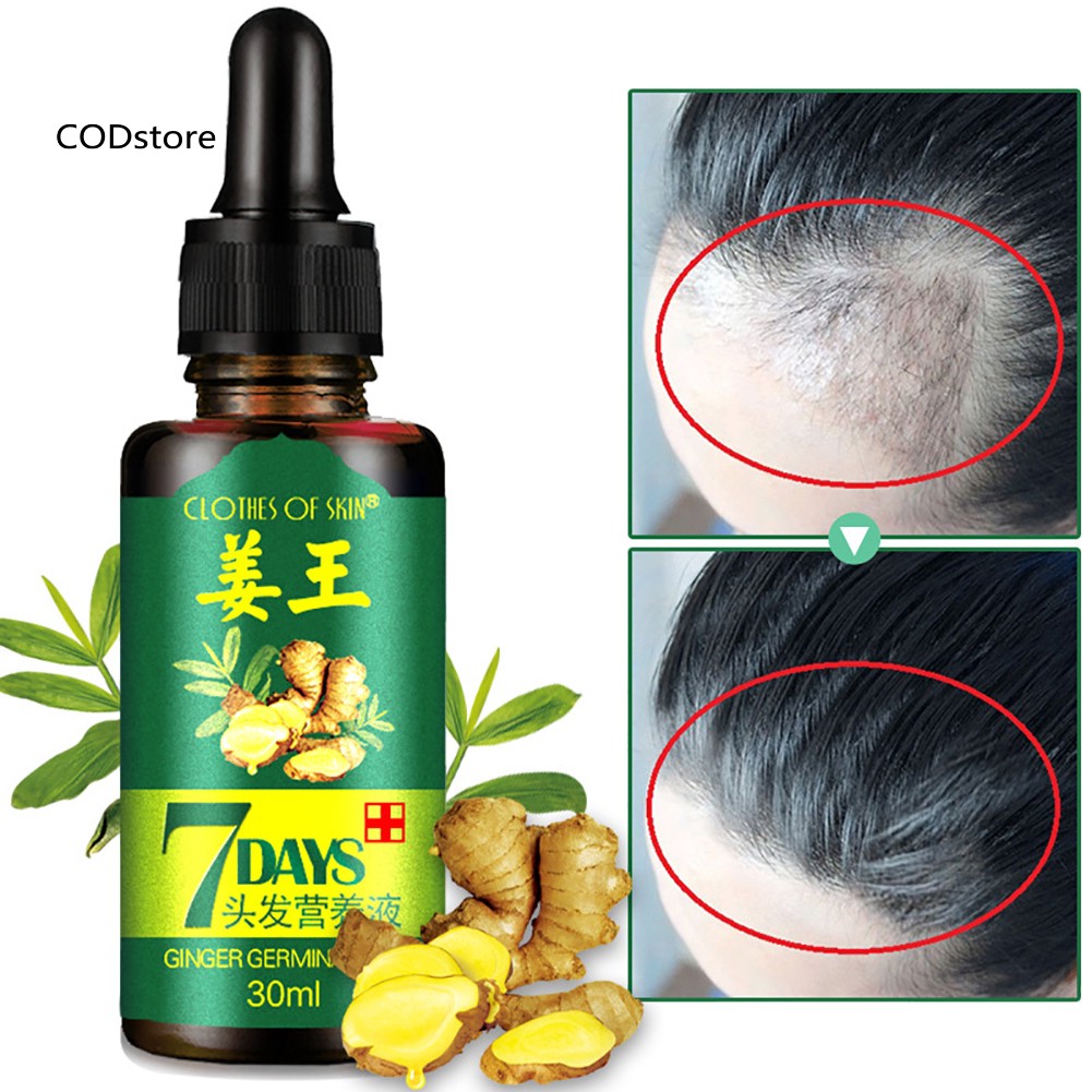 [Hàng mới về] Tinh dầu dưỡng tóc kích thích tóc mọc trong vòng 7 ngày chống rụng tóc