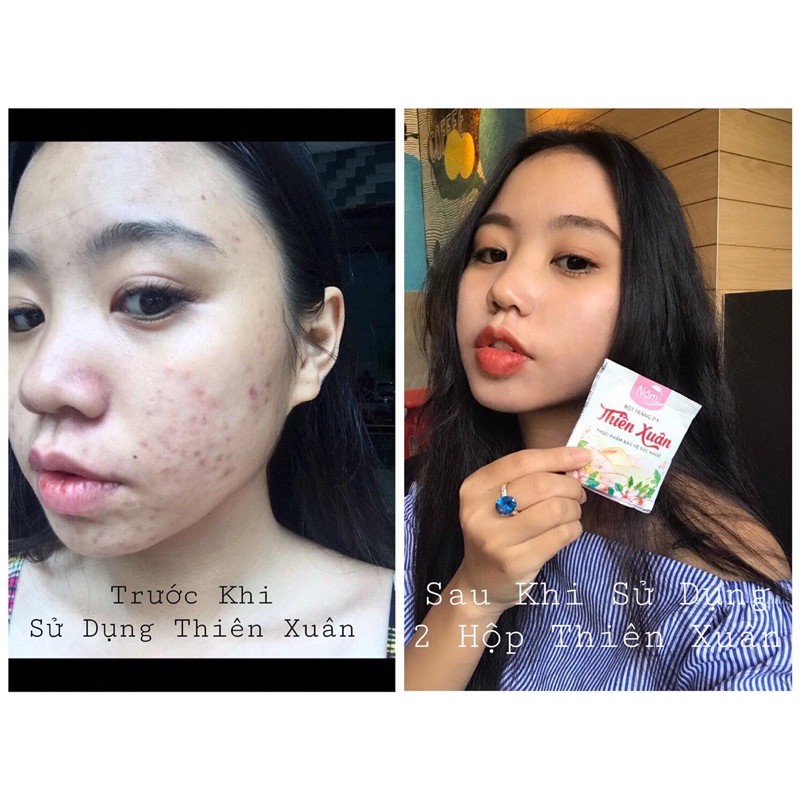 THIÊN XUÂN BỘT UỐNG TRẮNG DA THẦN TỐC TẶNG KÈM SAFFRON | BigBuy360 - bigbuy360.vn