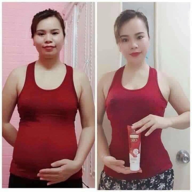 Kem tan mỡ olic chính hãng