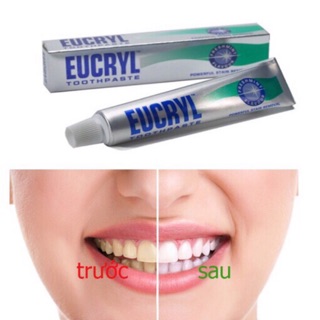 Kem đánh răng Eucryl – kem làm trắng răng từ Anh Quốc