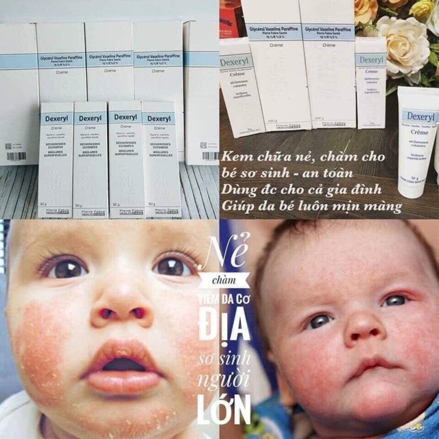 Kem Dexeryl❤️FREE SHIP❤️Kem Dexeryl Pháp 250gr❤️Dưỡng Ẩm, dưỡng da cho bé mịn màng | BigBuy360 - bigbuy360.vn