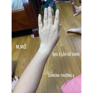 SET TẮM TRẮNG ĐẬU ĐỎ KOSXU