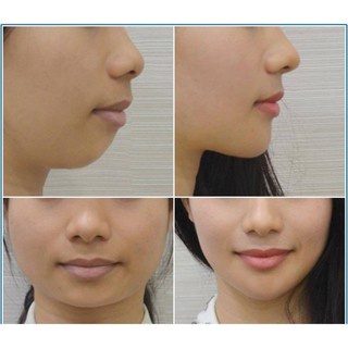 Kem Nâng Cằm Cổ Ngực Novosvit 50ml Nga. | BigBuy360 - bigbuy360.vn