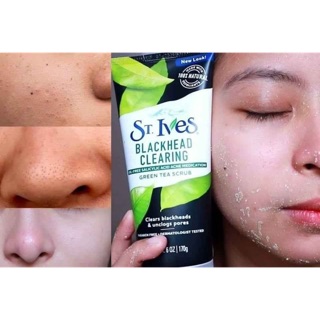 🍃 sữa rửa mặt tẩy da chết st. ives