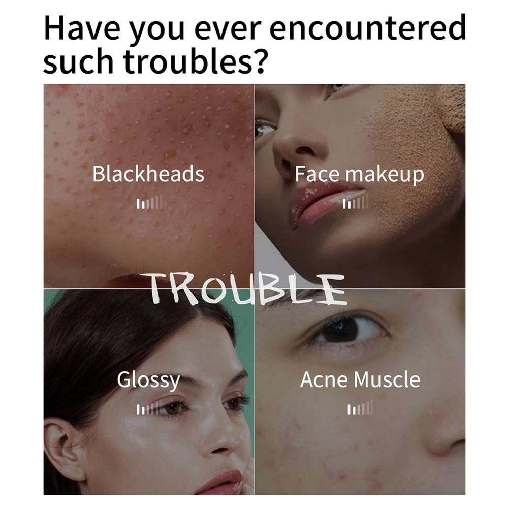 OCEANMAP Cây Lăn Massage Mặt Loại Bỏ Mụn Đầu Đen Tiện Dụng