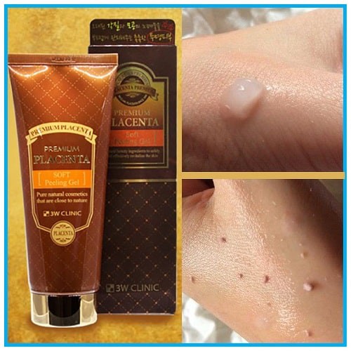 Kem Tẩy Tế Bào Chết 3W Clinic Premium Placenta Soft Peeling Gel 180ml