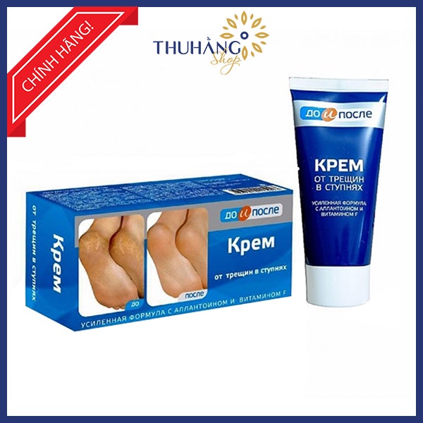 Kem nứt gót chân nga Kpem foot cream 50ml