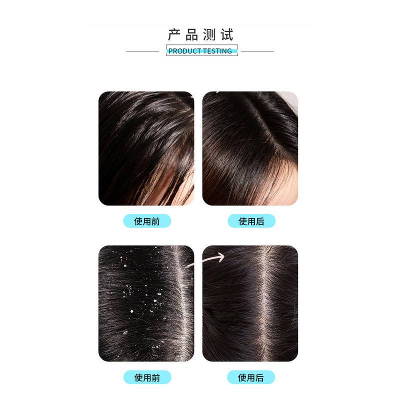 Kem Gội Đầu Khô Không Cần Gội Đầu Cho Nam Và Nữ