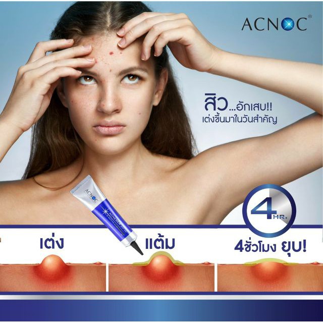 250g Gel_Trị_Mụn ACNOC 100% Nhập khẩu trực tiếp từ Thái Lan  #Gel_Trị_Mụn (Hàng Chuẩn Spa)