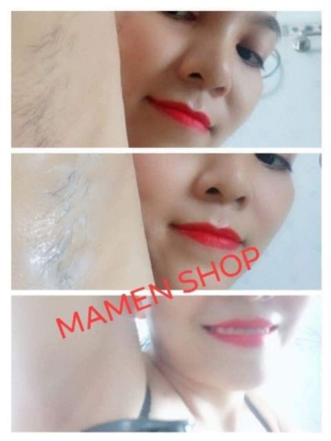 (Giá Sỉ)(Mua 1 tặng 1) Combo Gel Tẩy Râu Lông Vĩnh Viễn Không Mọc Lại | BigBuy360 - bigbuy360.vn