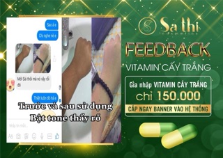 Combo 20v vitamin cấy trắng