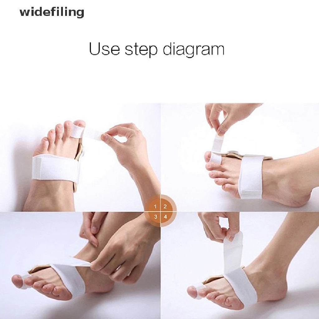 Dụng Cụ Nẹp Thẳng Chỉnh Hình Ngón Chân Cái Giảm Đau Hiệu Quả