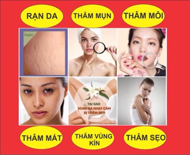 [Mã COSHOT21 giảm 10% đơn 450K] Tinh dầu trị thâm gia truyền ( trị thâm vùng kín, thâm sẹo, thâm muỗi đốt, mắt, môi,..) | BigBuy360 - bigbuy360.vn