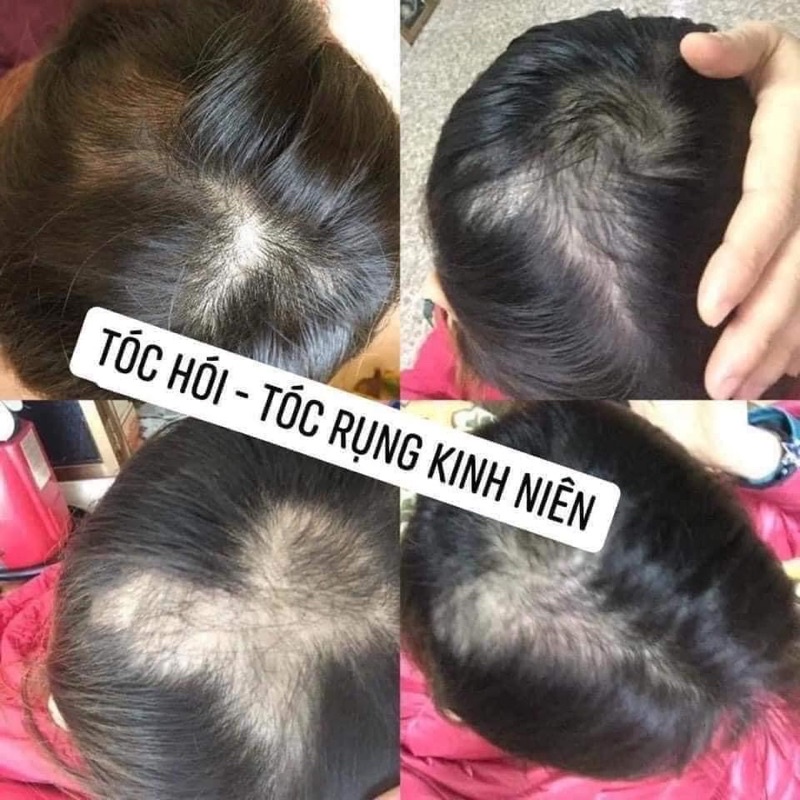 VIÊN UỐNG MỌC TÓC BIOTIN CỦA SAMSUNG FHARM - Biotin Nutri Day