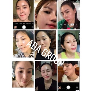 Serum căng bóng mờ thâm Mela White ADA GROUP