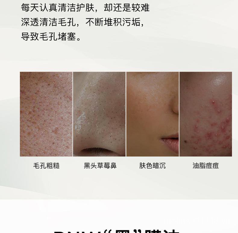 Mặt nạ RNW dưỡng ẩm làm sạch sâu loại bỏ mụn đầu đen