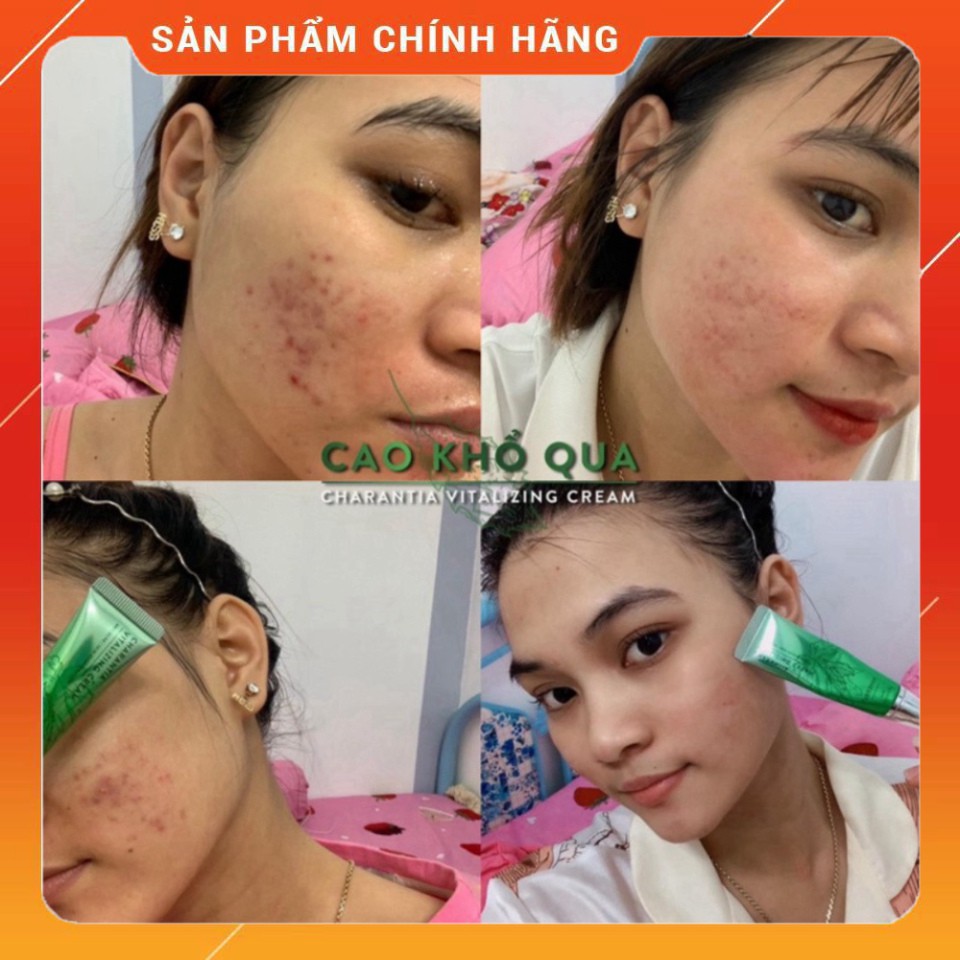 Cao Khổ Qua Dành Cho Da Mụn soHERBs 10ml