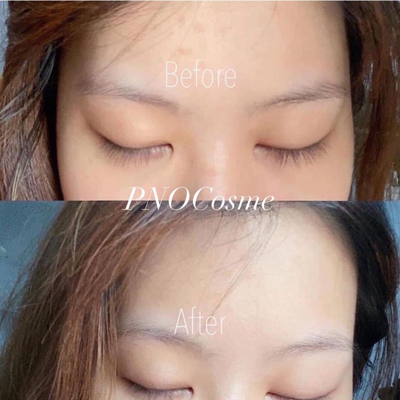 Melano CC Premium tinh chất mờ thâm mờ nám