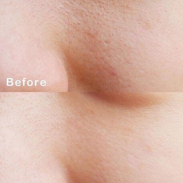 [Mã COS1904 giảm 8% đơn 300K] SỮA RỬA MẶT SE KHÍT LỖ CHÂN LÔNG LABO LABO SUPER-KEANA 120ml | BigBuy360 - bigbuy360.vn