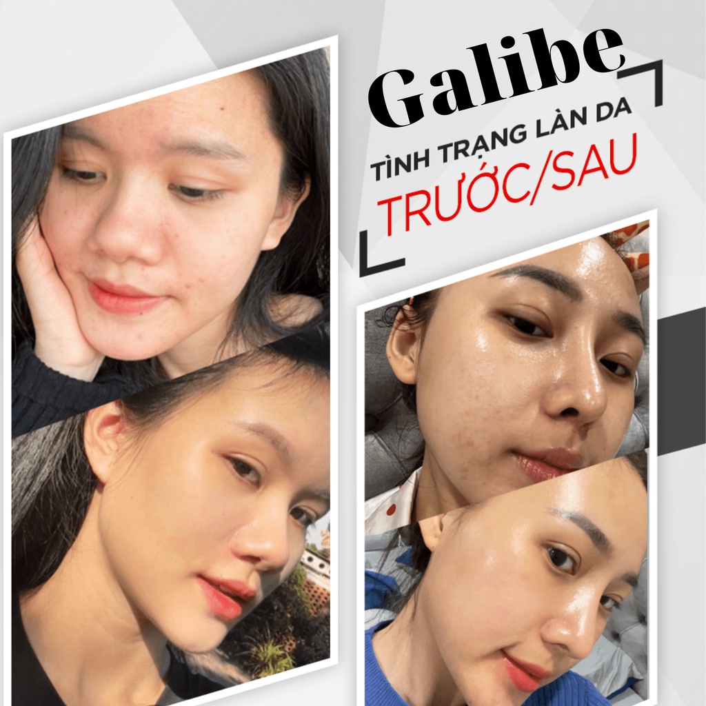 Peel da vi tảo LE PEAU peel da retinol, thay da sinh học giảm thâm, giảm sạm nám GALIBE OFFICIAL STORE