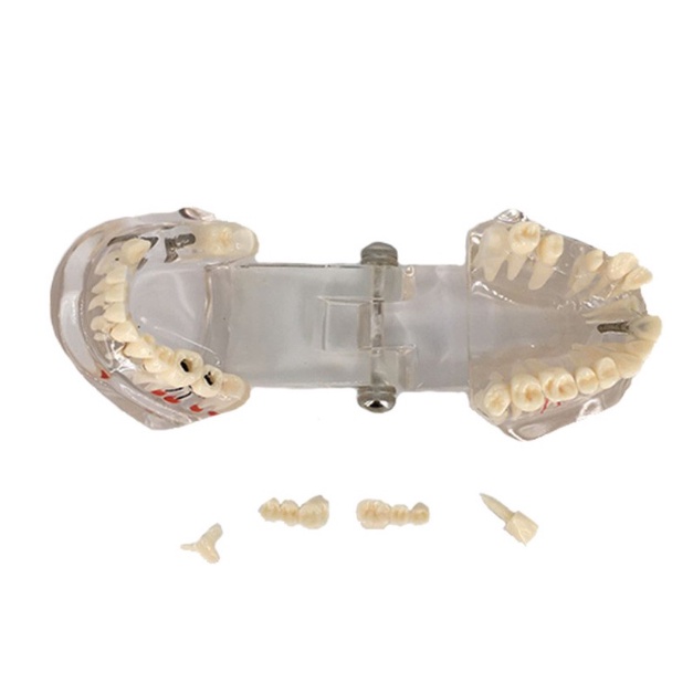 [Hàng mới về] Mô hình hàm răng đa năng chuyên dụng dành cho nha khoa