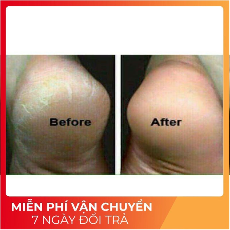 Kem Dầu Ngựa Nứt Gót Chân, Nẻ Da Tay Hàng Chất Lượng 30gr
