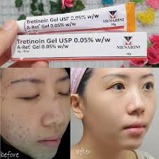 Tretinoin Aret Ấn Độ, Gel Giảm Mụn, Mờ Thâm Nám, Chống Lão Hóa, Dưỡng Da Mạnh Mẽ Collagen/ elastin 20g - Xoaiauth