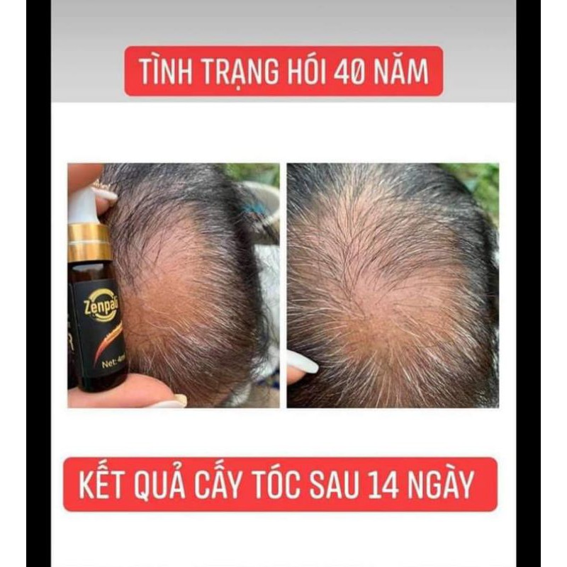 Dưỡng mi, mọc tóc DR.HAIR ZENPALI CHÍNH HÃNG | BigBuy360 - bigbuy360.vn