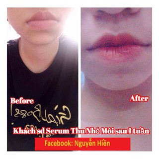 Tinh Chất Thon Gọn Môi Miracle