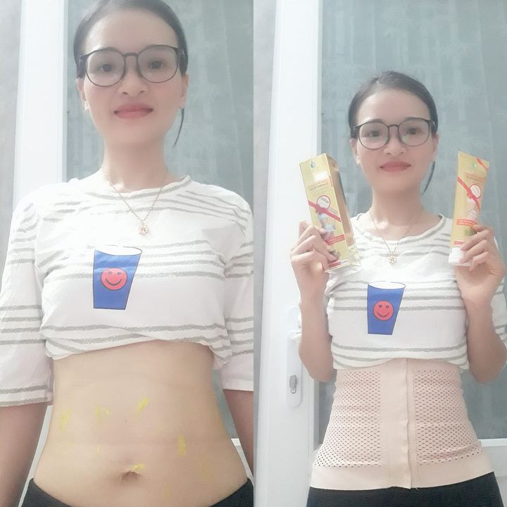 [Chính Hãng] [MẪU MỚI 2020] KEM TAN MỠ NGÂN BÌNH CAO CẤP  + Tặng Thước Dây  -  Đánh Bay Mỡ Thừa | BigBuy360 - bigbuy360.vn