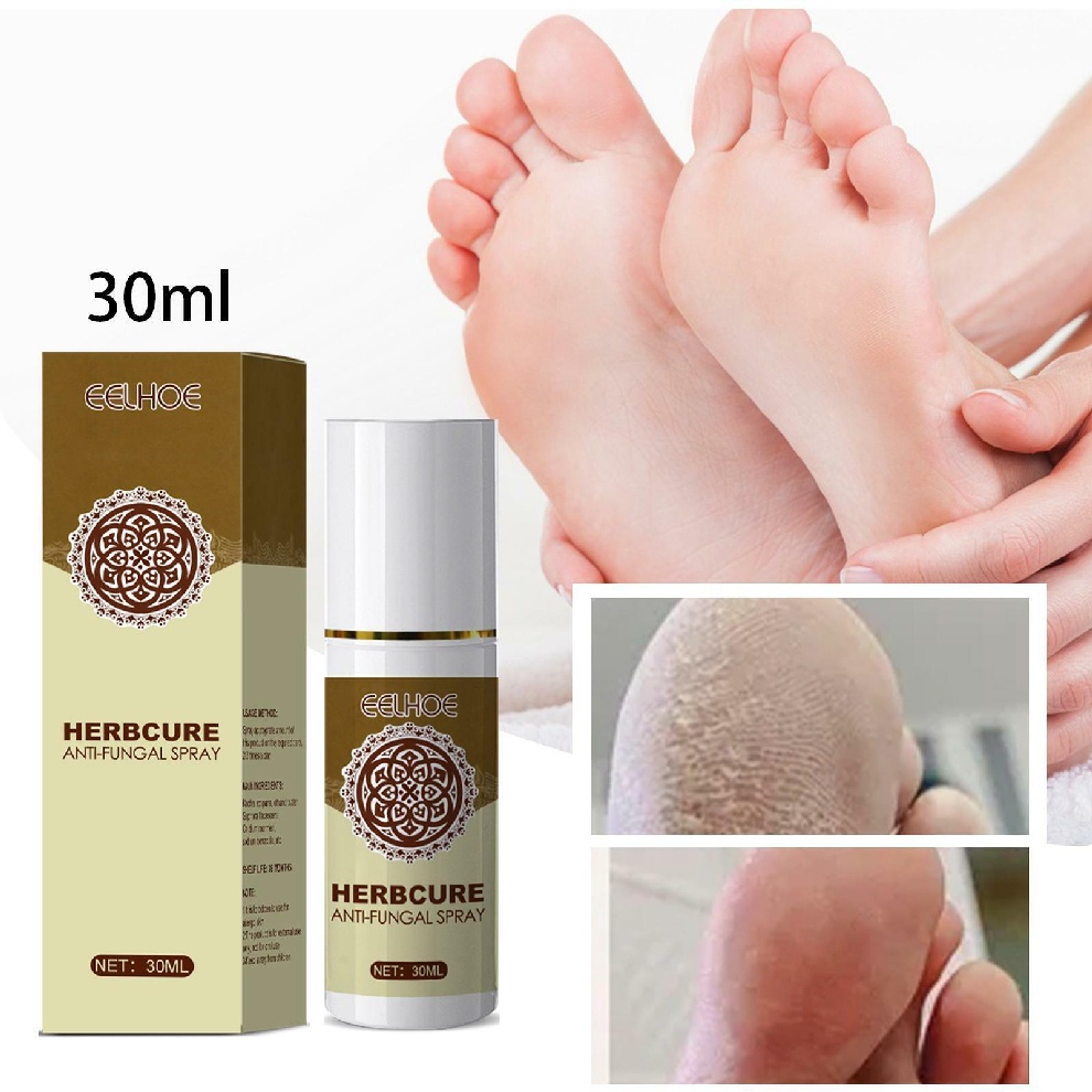 [Hàng mới về] Xịt dưỡng bàn chân thảo dược cải thiện tình trạng nấm chăm sóc làn da 30ml