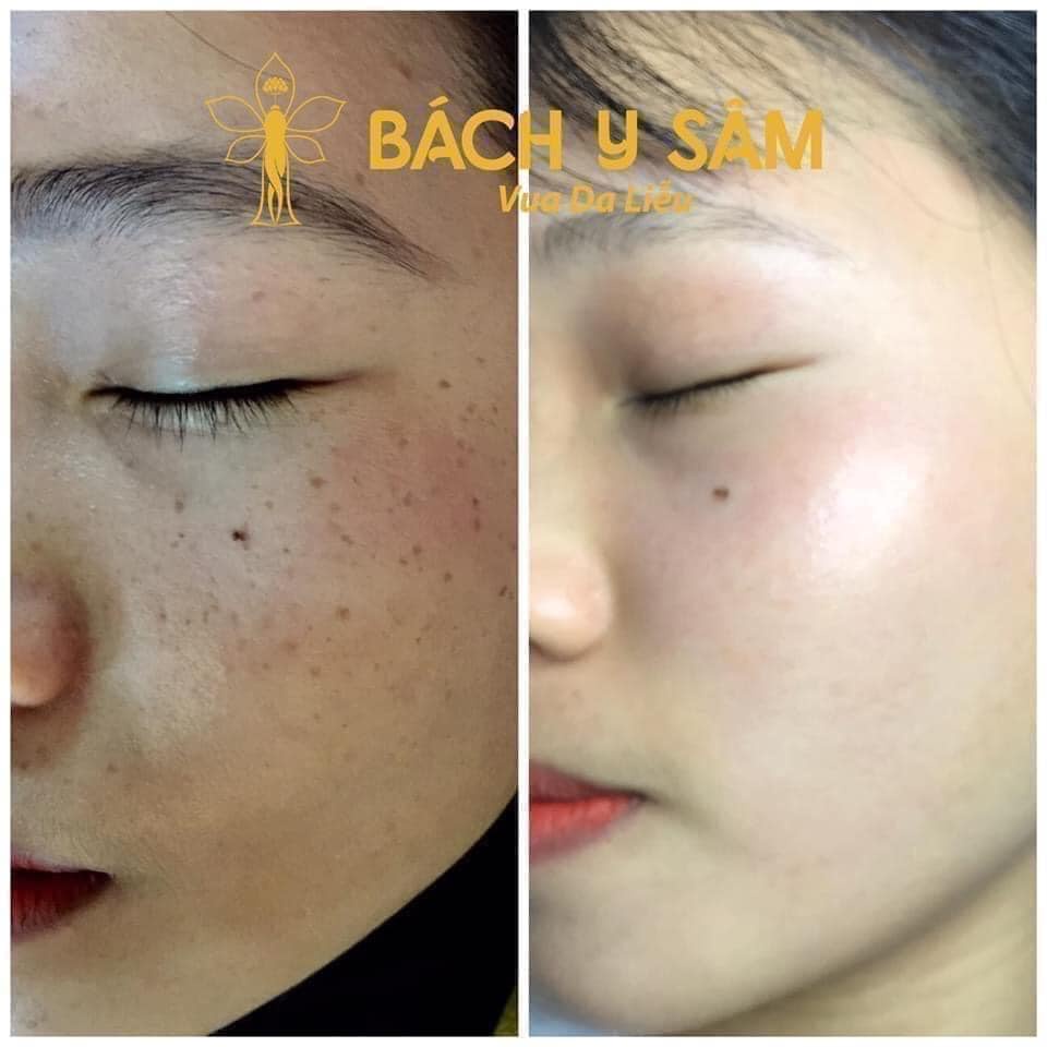Bách Y Sâm 02 100ML Mẫu Mới Của Bạch Linh 02 Date 2026
