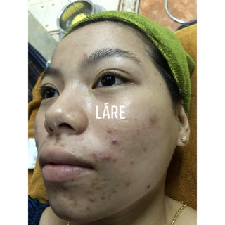 SERUM LÁRE THANH DƯỢC - SIZE 50ML