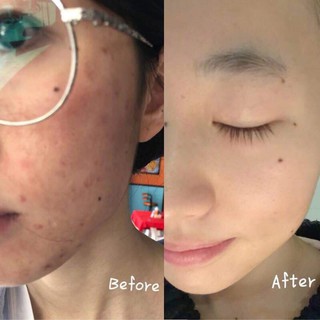 Sữa rửa mặt CERAVE