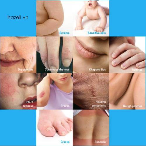 Kem Dưỡng La Roche CICAPLAST BAUME B5