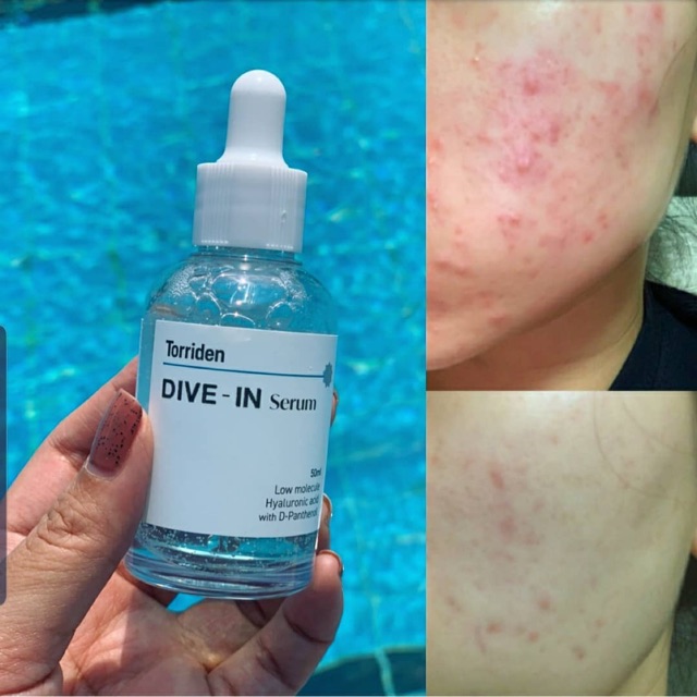 Serum cấp nước TORRIDEN DIVE-IN SERUM